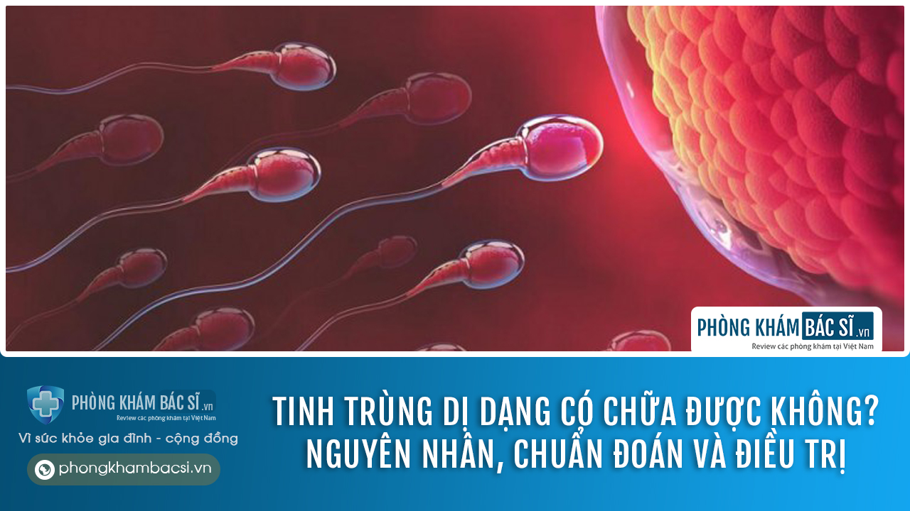 Tinh trùng dị dạng là gì Nguyên nhân và Cách điều trị