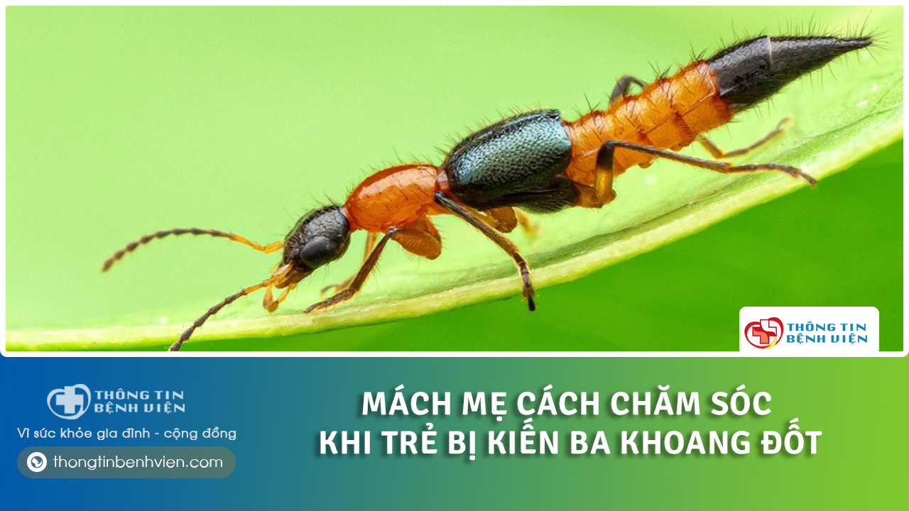 Trẻ bị kiến ba khoang đốt