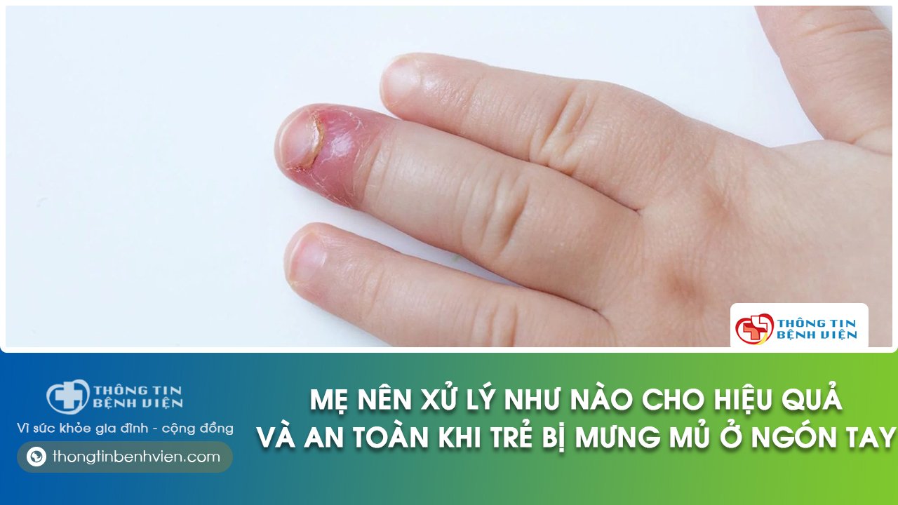 ngón tay trẻ bị mưng mủ