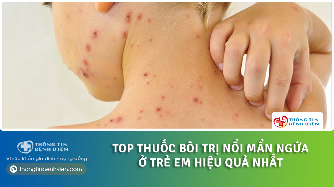 trẻ bị nổi mẩn ngứa