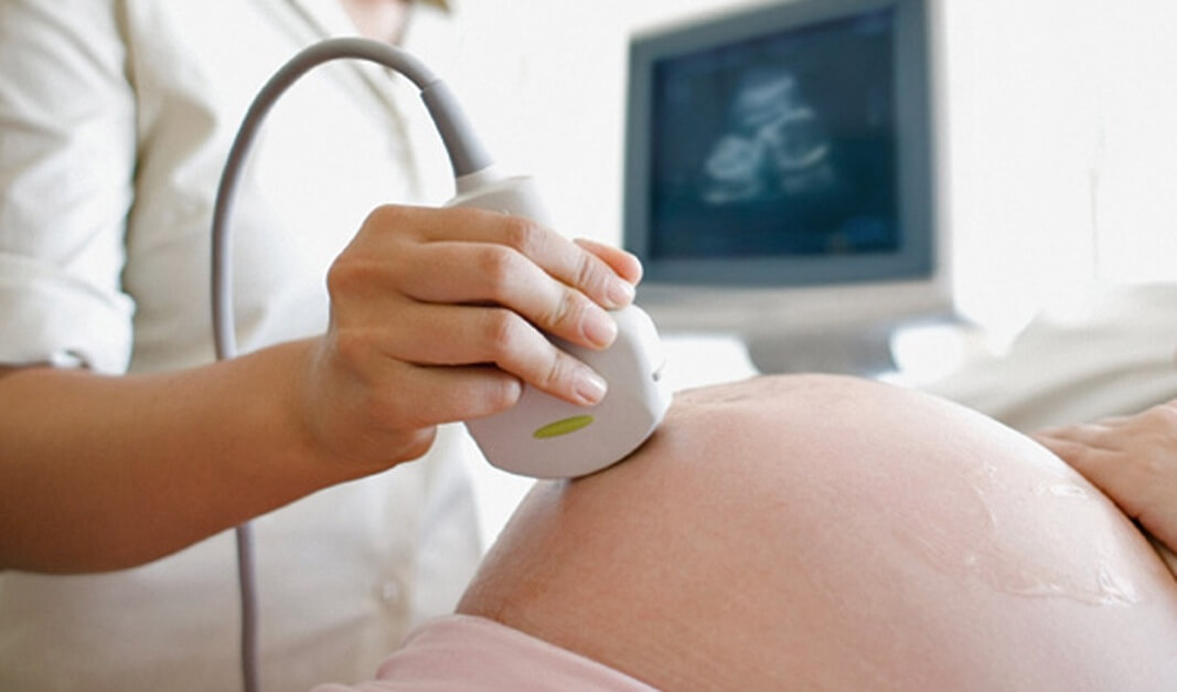 đi siêu âm để kịp thời phát hiện bệnh Down