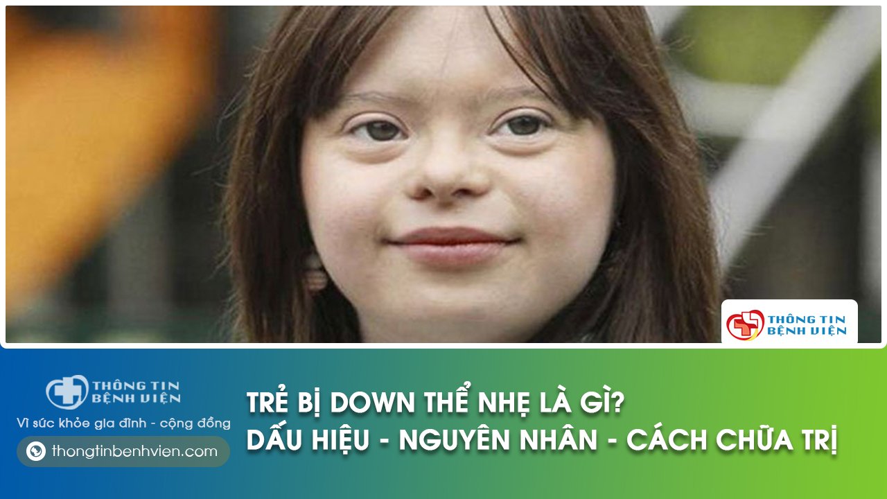 trẻ bị down thể nhẹ