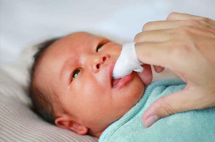 dùng một miếng gạc vải sạch để sơ lưỡi cho trẻ