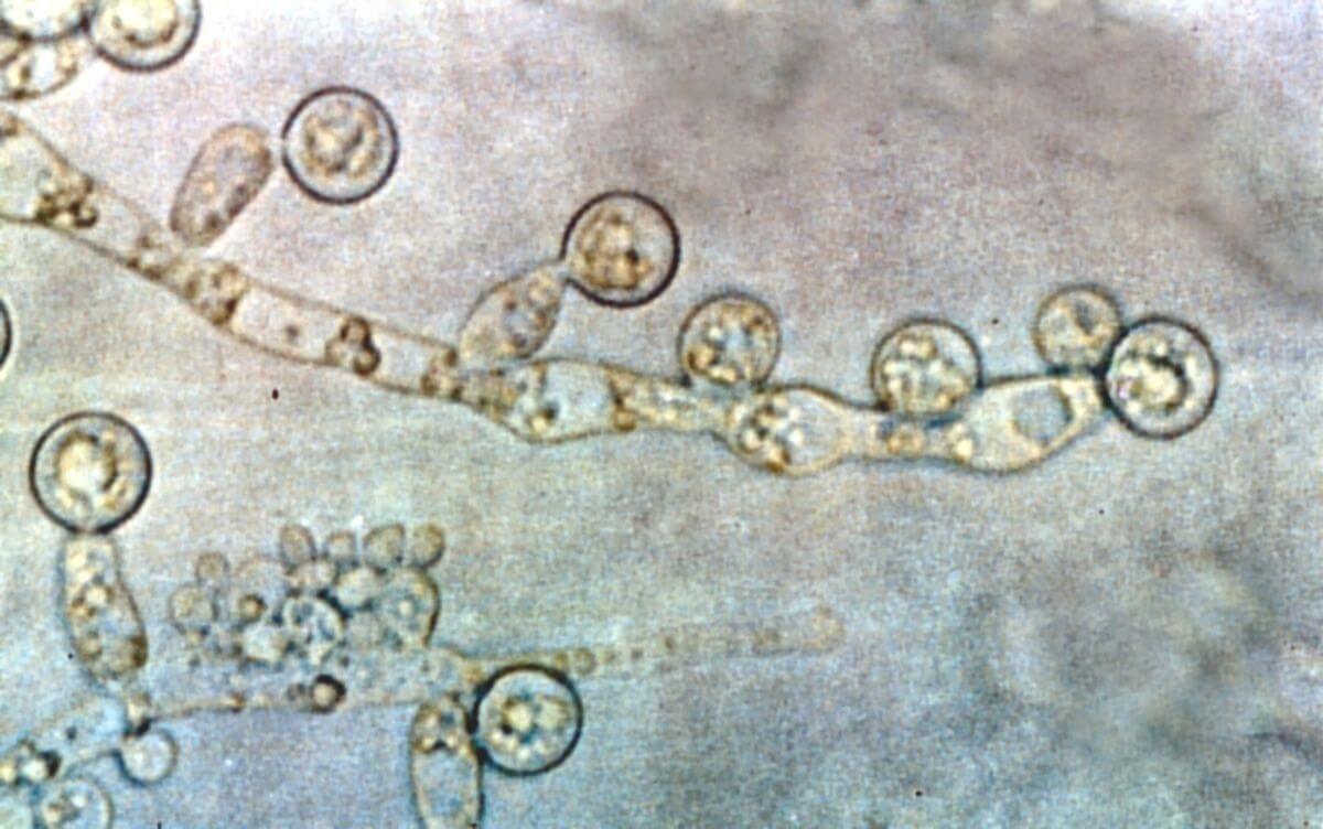 hình ảnh nấm Candida Albicans dưới kính hiển vi