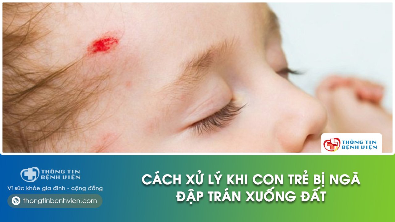 Trẻ bị ngã đập trán xuống đất