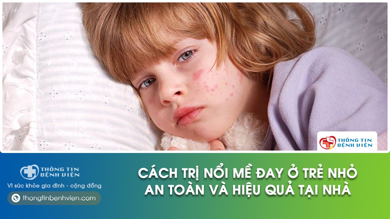 trẻ bị nổi mề đay