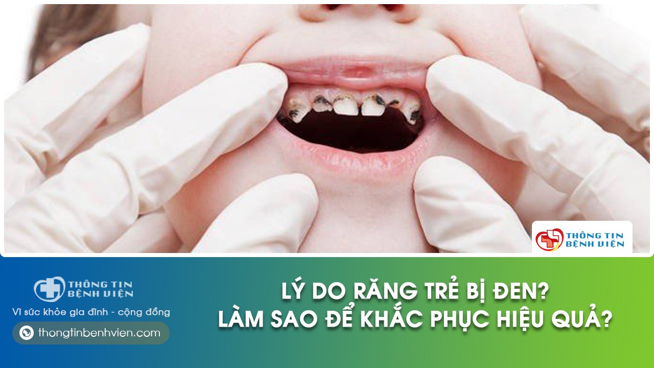 răng trẻ bị đen