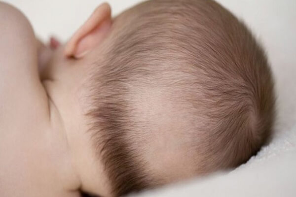 Rụng tóc do các bệnh tự miễn