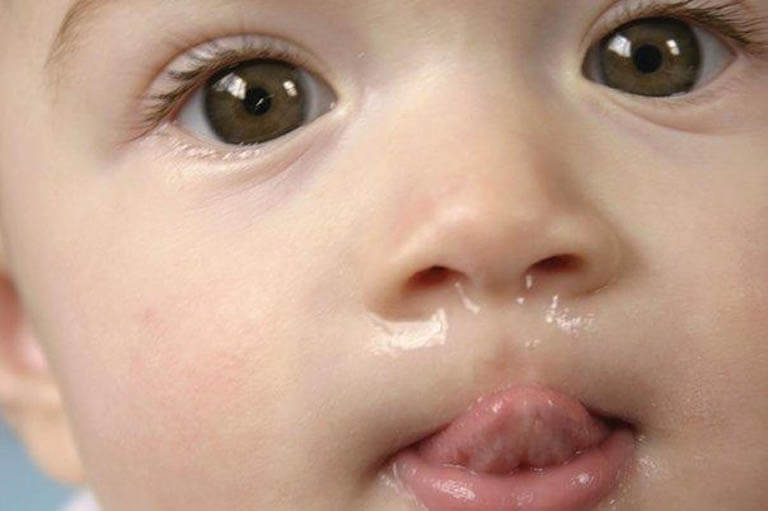 trẻ vị sổ mũi 