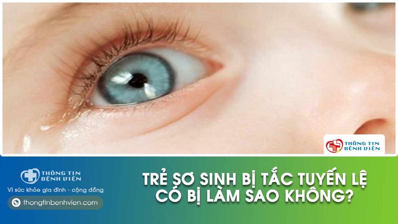 Trẻ sơ sinh bị tắc tuyến lệ