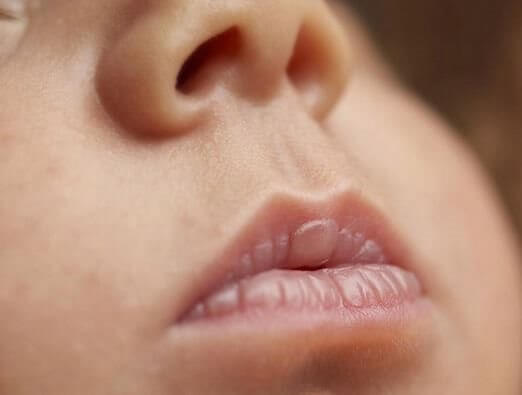 trẻ sơ sinh bị khô môi