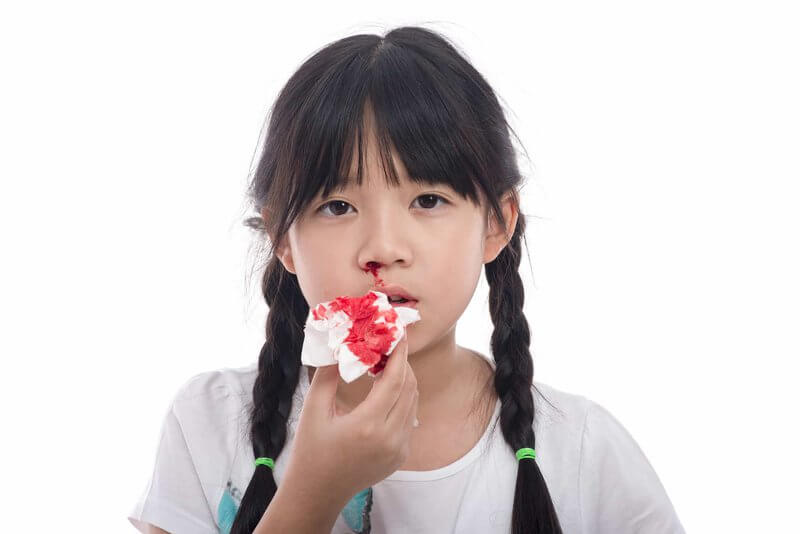 Mẹ xác định máu chảy từ phía cánh mũi nào