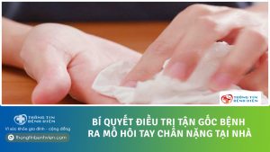 Bí quyết chữa bệnh ra mồ hôi tay chân nặng tại nhà. Điều trị tận gốc