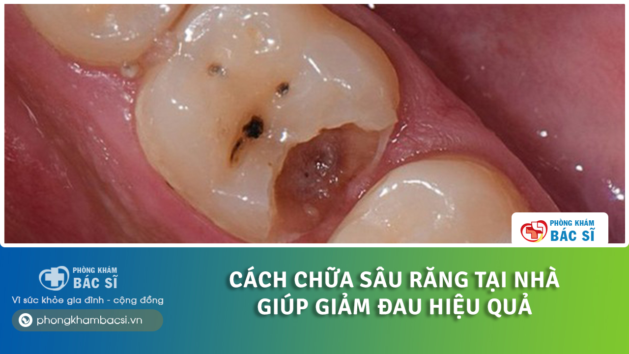 cách chữa lỗ sâu răng tại nhà