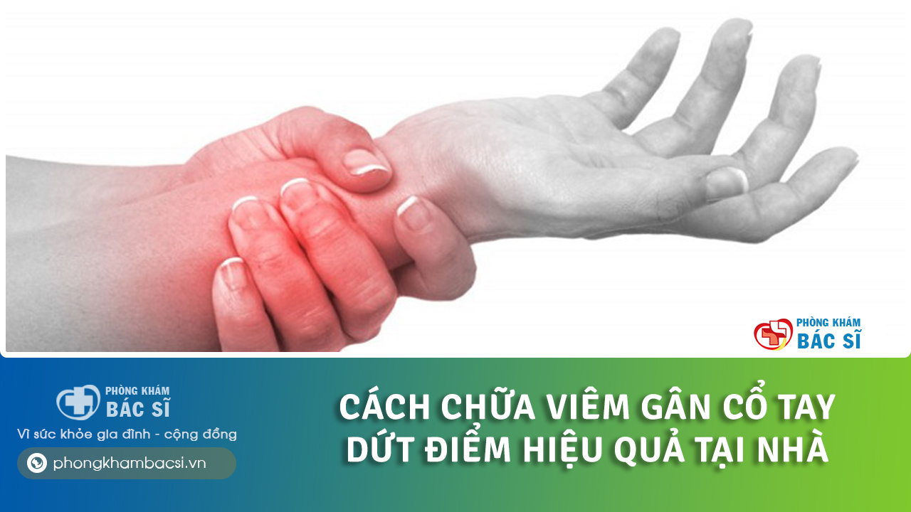 cách chữa viêm gân cổ tay tại nhà
