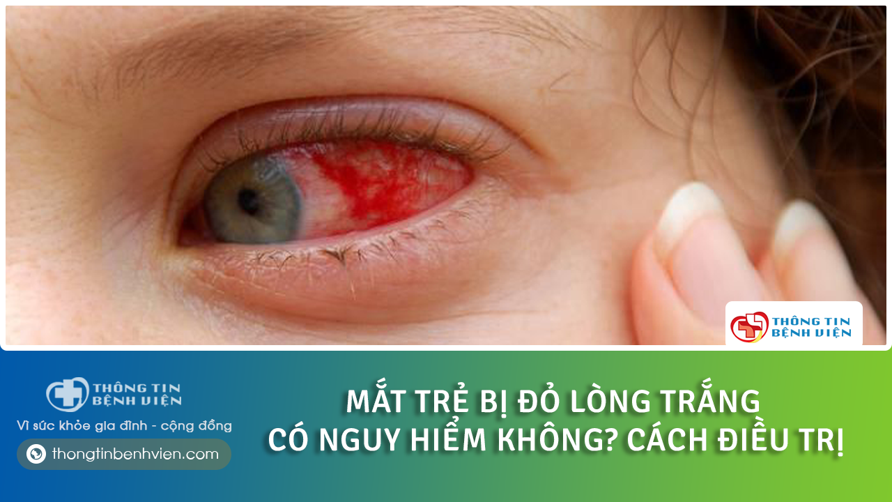 Mắt trẻ bị đỏ lòng trắng có nguy hiểm không? Nguyên nhân và cách điều trị