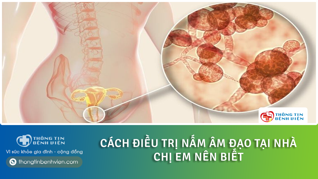Bị nấm âm đạo có nguy hiểm không? Cách chữa nấm âm đạo tại nhà hiệu quả