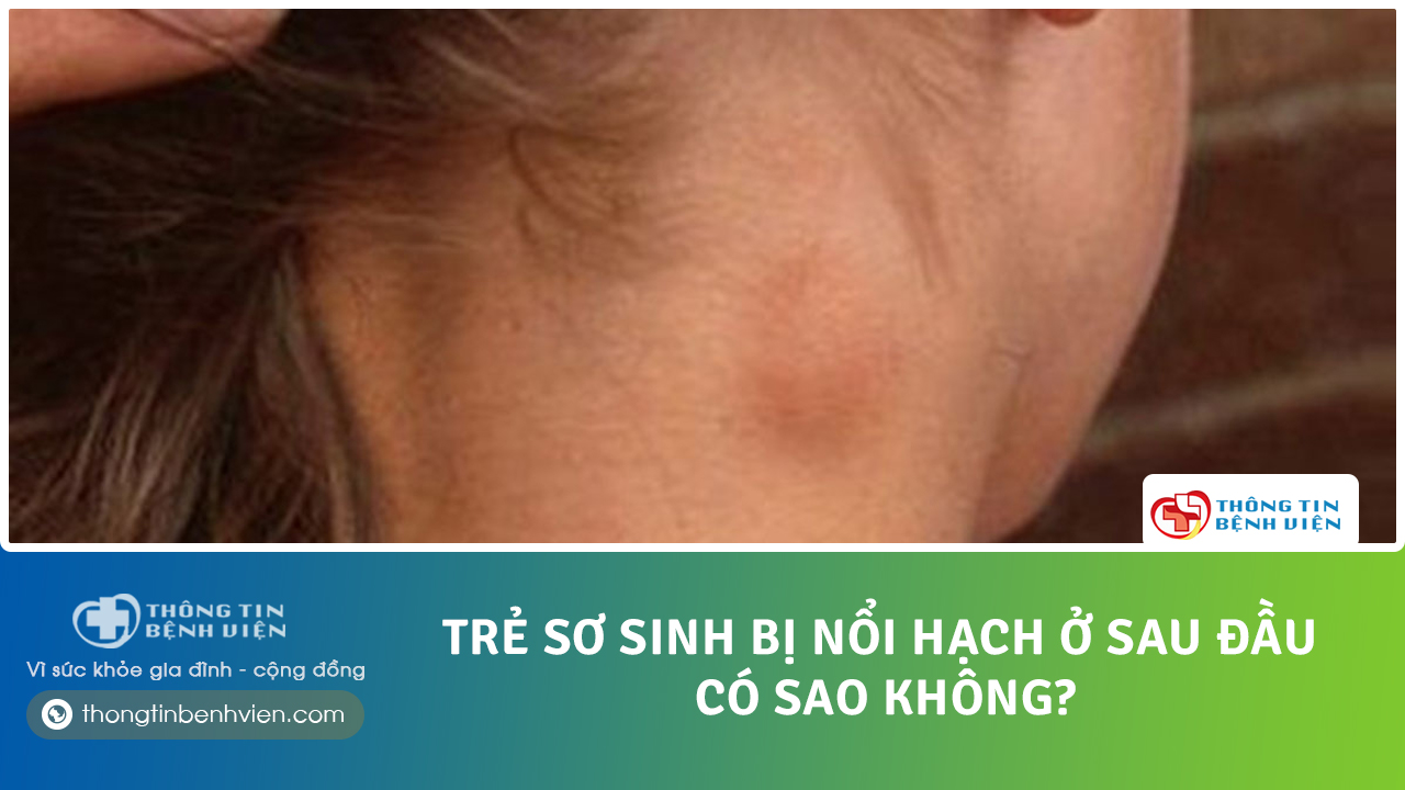 NOI-HACH-SAU-DAU
