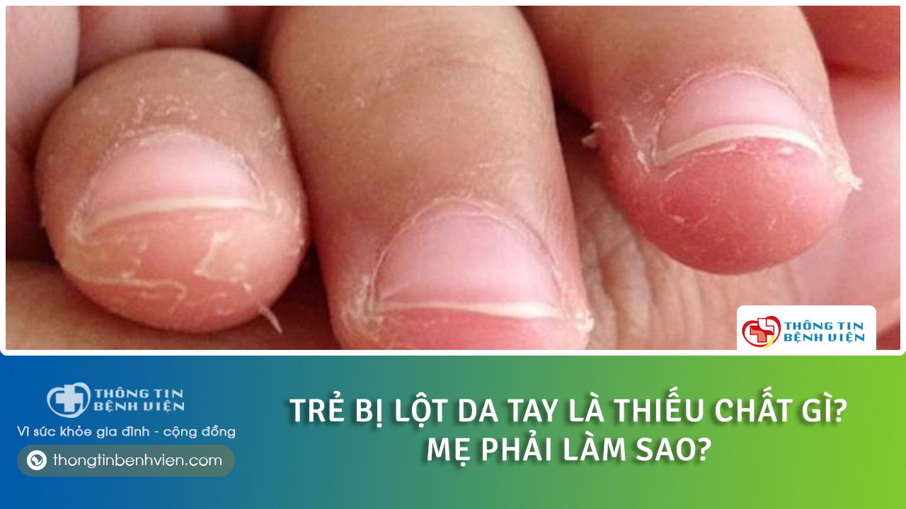 Trẻ bị lột da tay là thiếu chất gì? Mách mẹ cách chữa trị