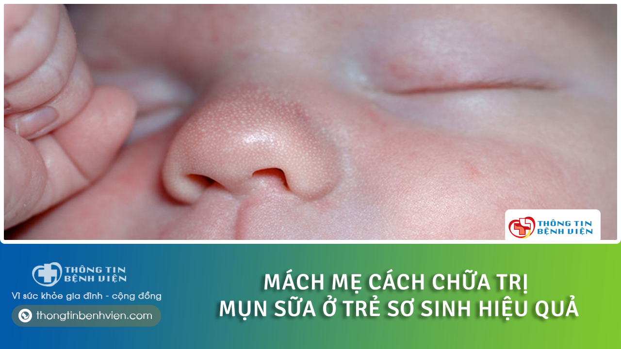 Mụn sữa ở trẻ sơ sinh: nguyên nhân và cách chữa trị hiệu quả
