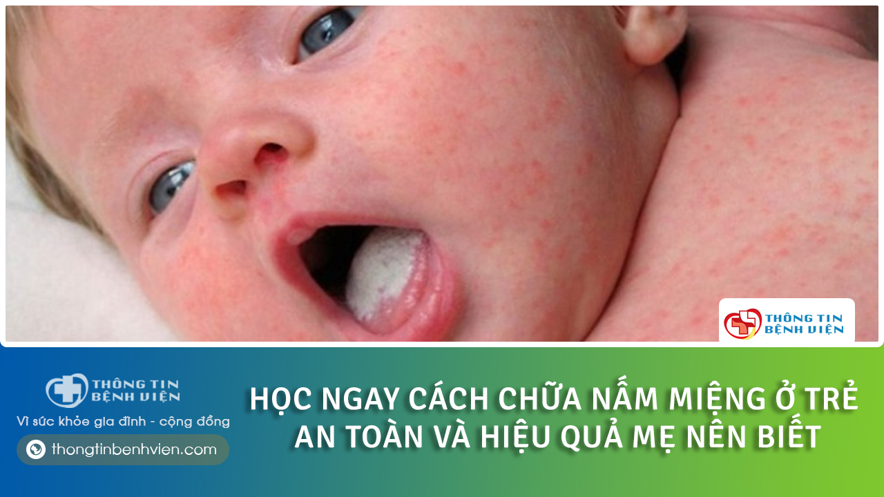 Học ngay cách chữa nấm miệng ở trẻ sơ sinh tại nhà an toàn và hiệu quả mẹ nên biết