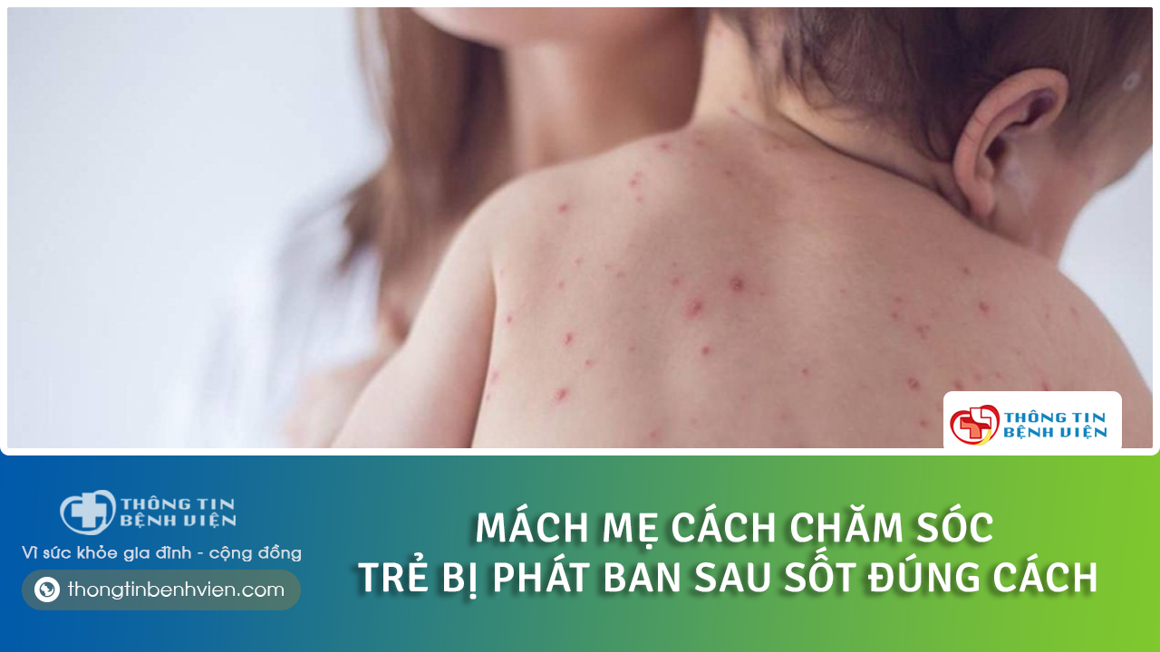 trẻ bị phát ban sau sốt