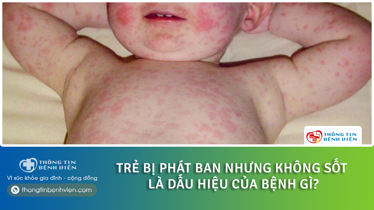 Trẻ bị phát ban nhưng không sốt có phải bất thường?