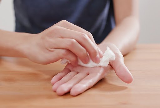 Biểu hiện thường thấy của bệnh ra mồ hôi tay chân