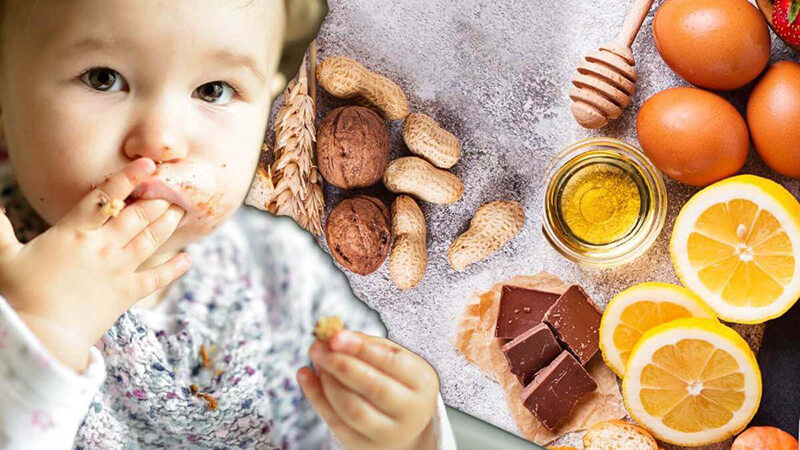 Dị ứng với thức ăn là một trong nhwuxng nguyên nhân gây ra nổi mề đay