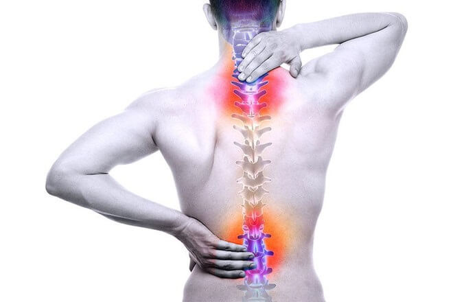 Đau lưng được biết đến như một căn bệnh liên quan chủ yếu đến các cấu trúc xung quanh vùng xương cột sống
