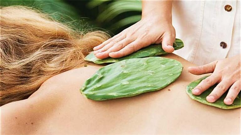 Đắp xương rồng giúp giảm đau khớp vai