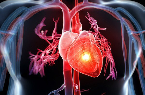 Bệnh lý về tim