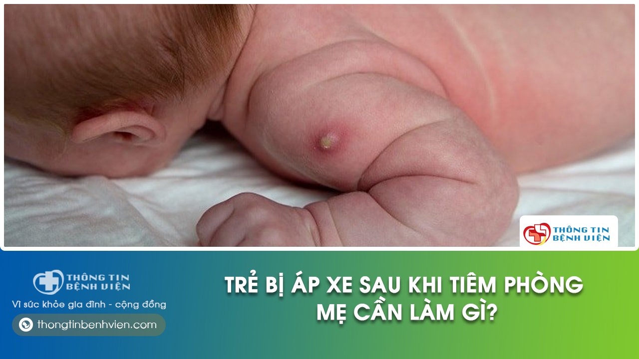 trẻ bị áp xe sau khi tiêm phòng
