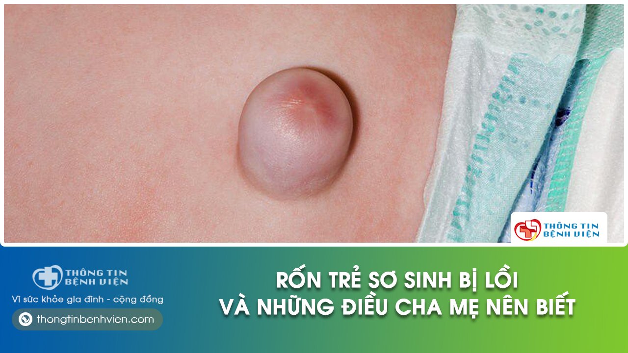 trẻ sơ sinh bị lồi rốn phải làm sao