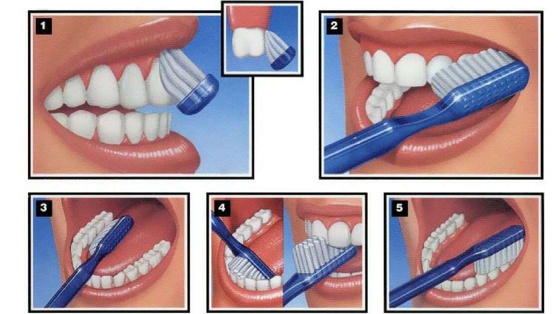 Việc chải răng đúng cách sẽ giúp bạn có một hàm răng chắc khỏe cũng như tránh được tình trạng viêm lợi