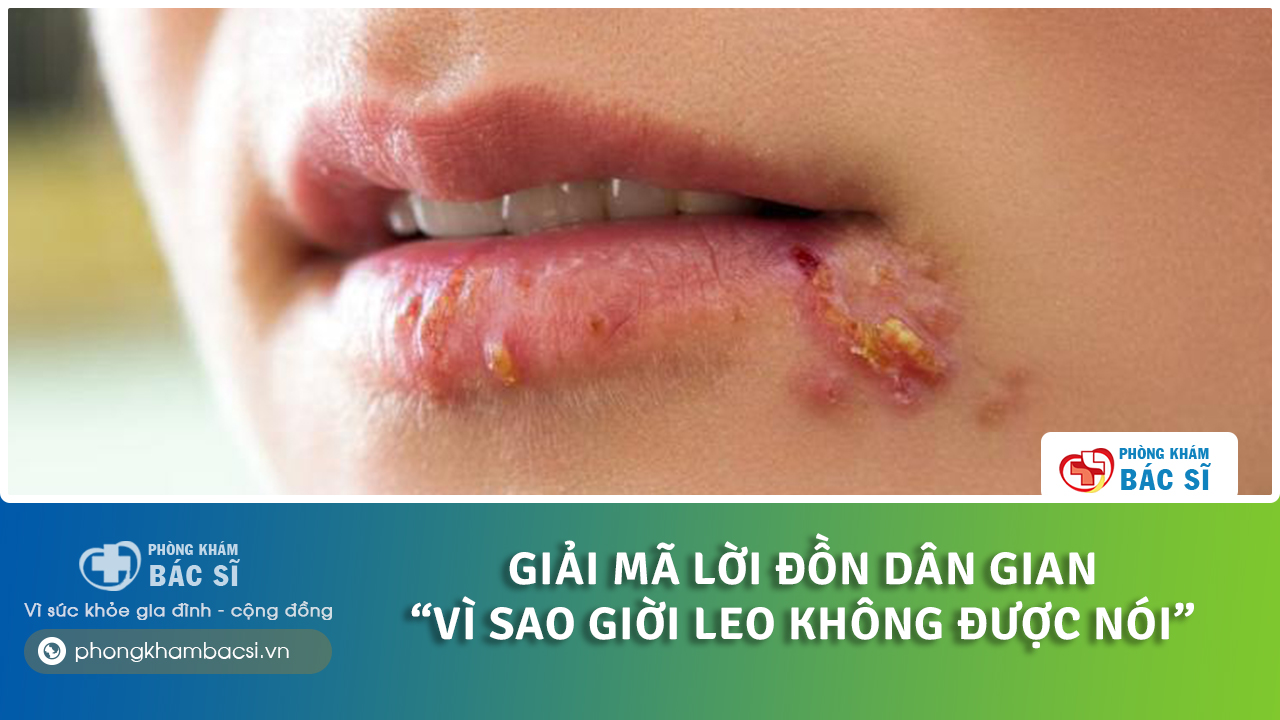 tại sao bị giời leo không được nói