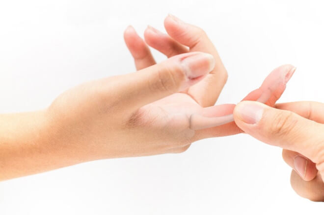 Đau nhức khớp ngón tay là vật chủ (con người) cảm thấy đau nhức, ê buốt, mất sức lực từ sâu bên trong xương ở các khớp ngón tay