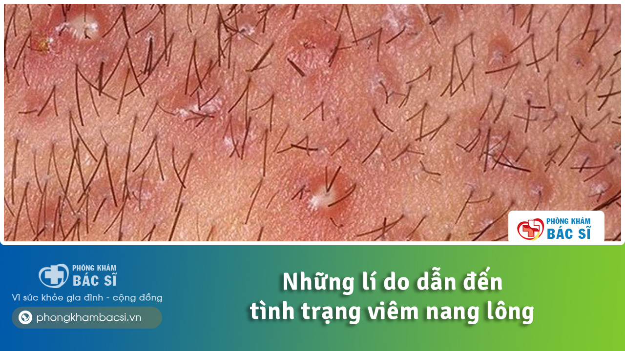 Những lí do dẫn đến viêm nang lông