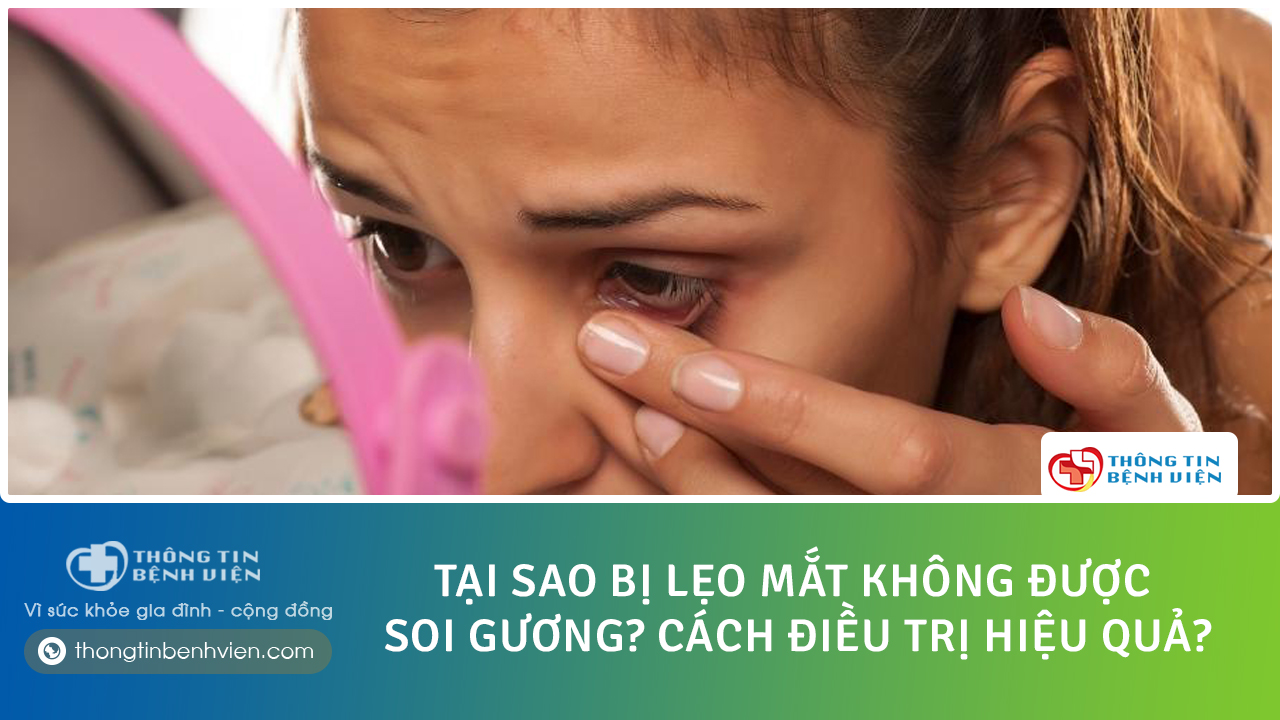 Tại sao bị lẹo mắt không được soi gương? Cách điều trị hiệu quả?