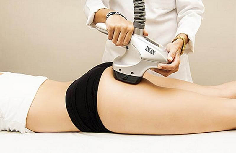 Điều trị bằng laser 