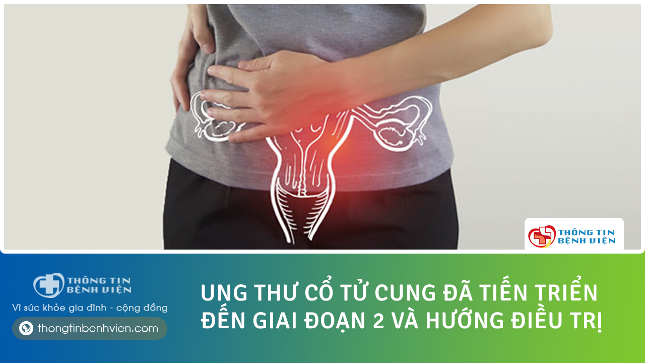 Dấu hiệu cho thấy ung thư cổ tử cung đã tiến triển đến giai đoạn 2 và hướng điều trị
