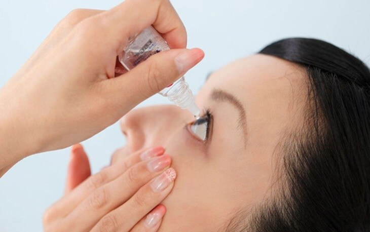 Thuốc nhỏ kháng viêm cũng có thể được chỉ định trong một số trường hợp viêm bờ mi