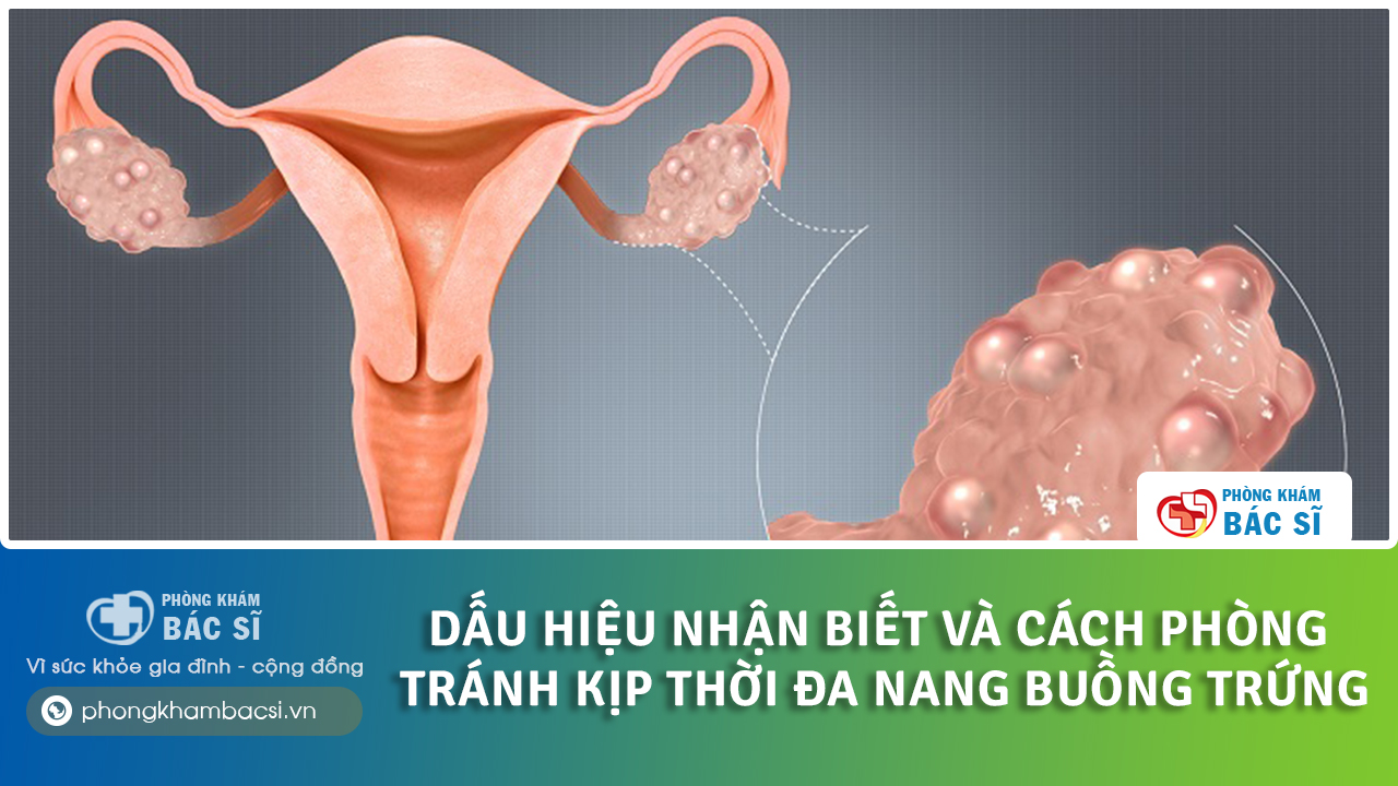 tại sao bị đa nang buồng trứng