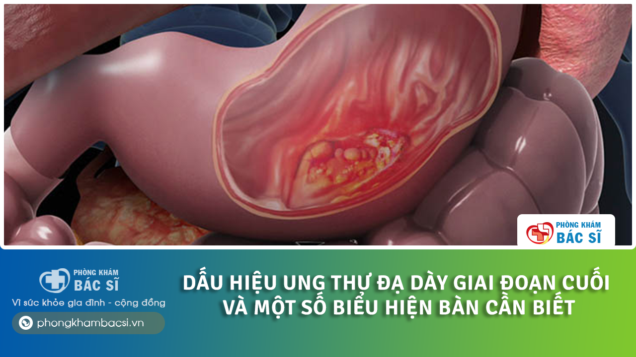 dấu hiệu ung thư dạ dày giai đoạn cuối
