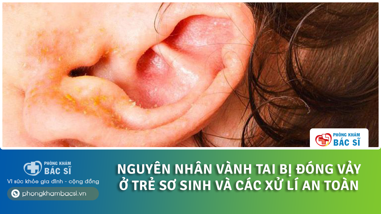 vành tai bị đóng vảy ở trẻ sơ sinh