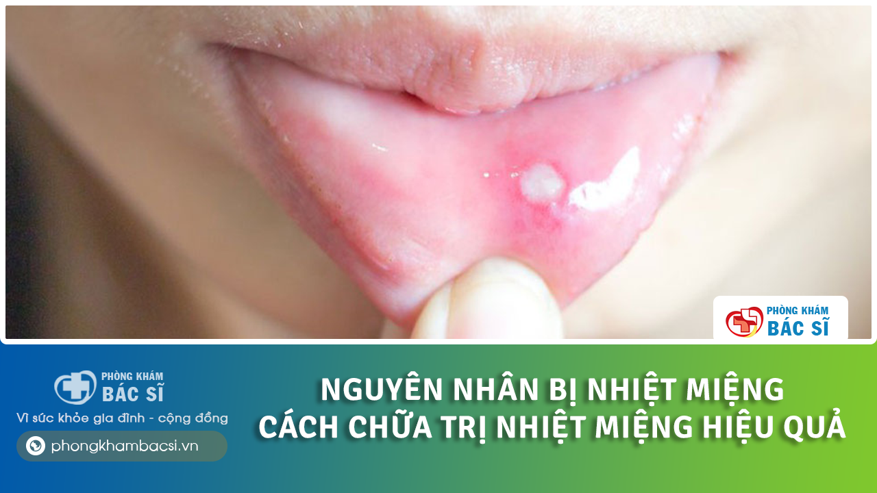 tại sao bị nhiệt miệng liên tục