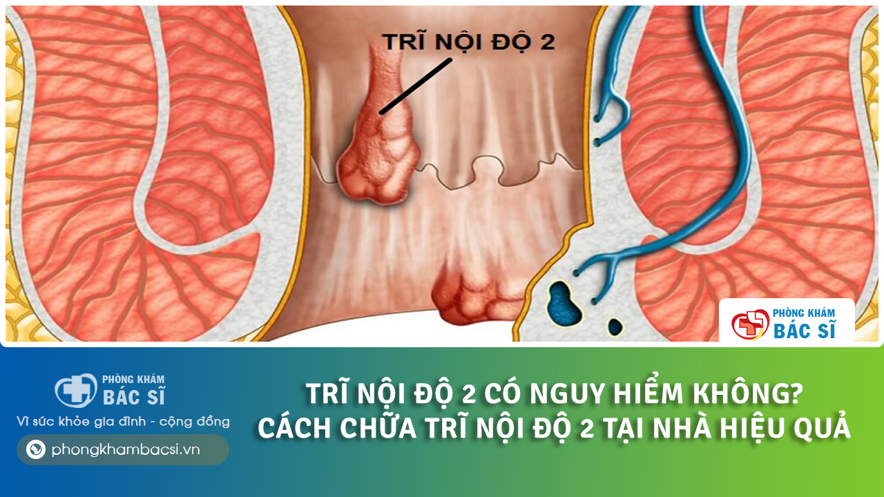 Cách chữa trĩ nội độ 2 tại nhà