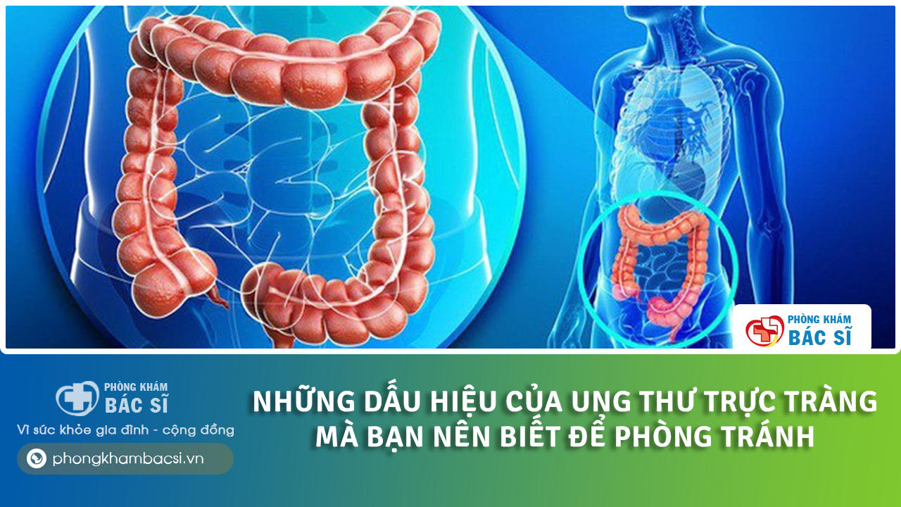dấu hiệu ung thư đại tràng giai đoạn 1