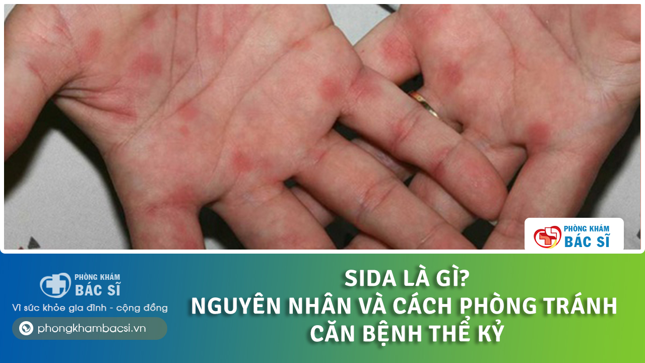 sida là bệnh gì