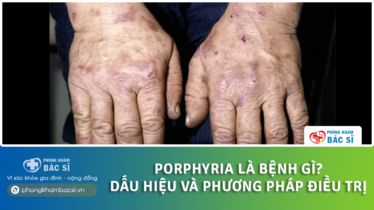 Porphyria là bệnh gì